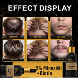 Hair Growth For Men & Women 5% Minoxidil & Biotin Hair Serum, Loss/Beard Growth