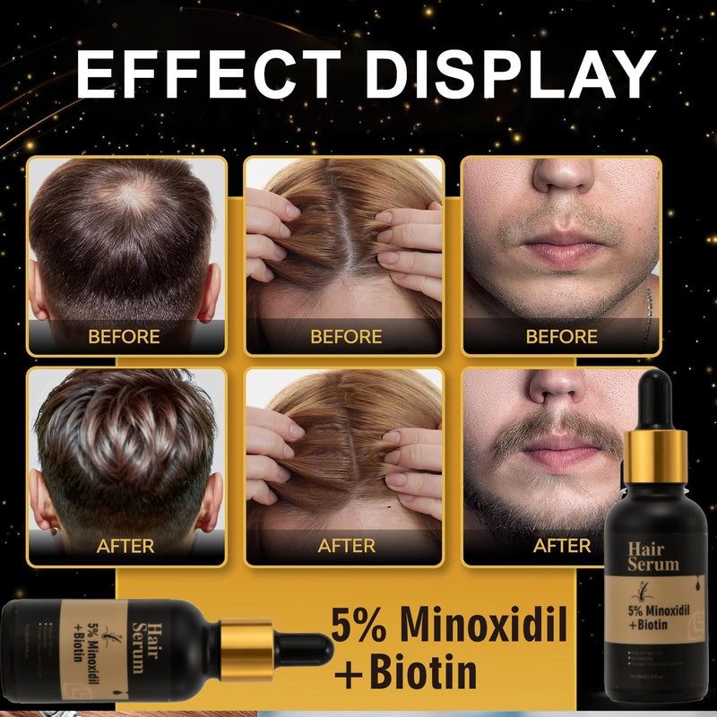 Hair Growth For Men & Women 5% Minoxidil & Biotin Hair Serum, Loss/Beard Growth